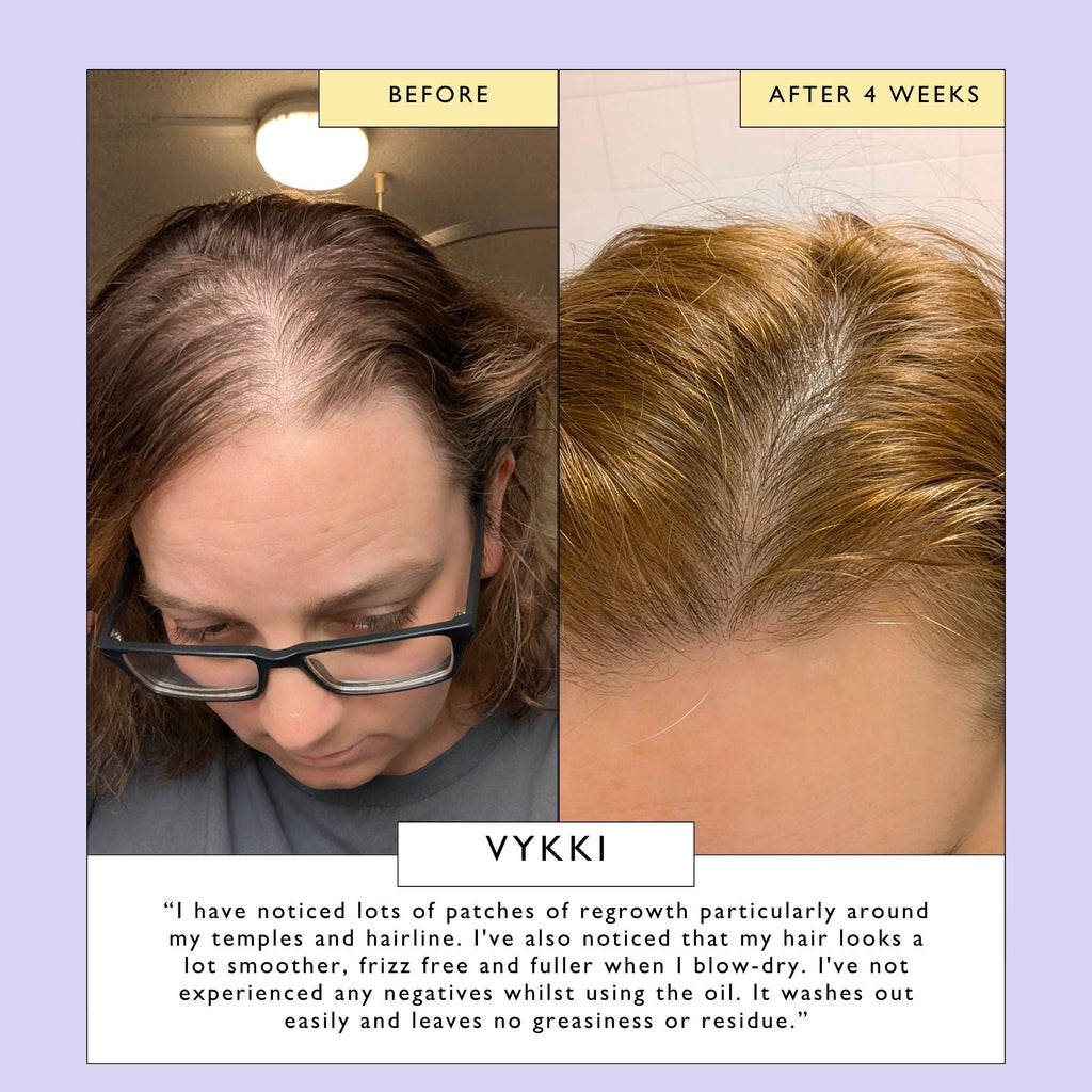 Aceite para cuero cabelludo y cabello con manteca de bacuri y aceite de ricino