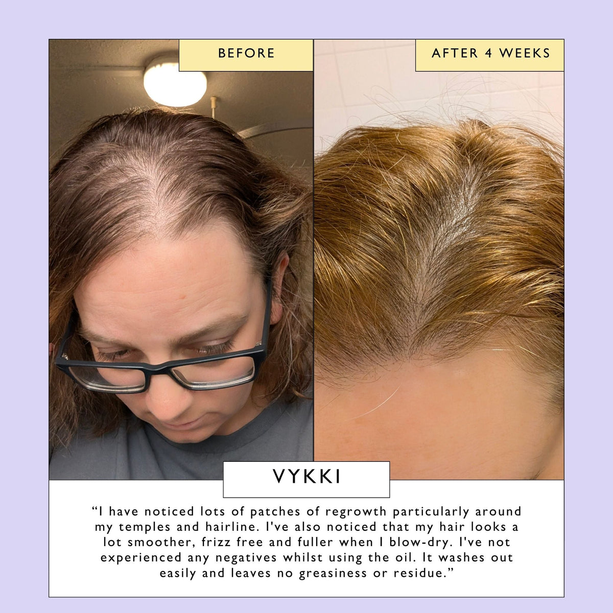Aceite para cuero cabelludo y cabello con manteca de bacuri y aceite de ricino